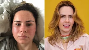 ana-paula-renault-fez-procedimento-estetico-com-laser-em-2019-1775911823341_v2_900x506.jpg.webp